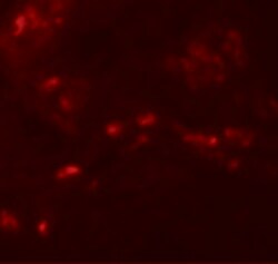 Invitrogen SPRYD4 Polyclonal Antibody 100 &mu;g | Buy Online | Invitrogen&trade; | Fisher Scientific