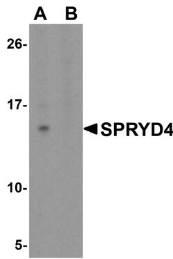 Invitrogen SPRYD4 Polyclonal Antibody 100 &mu;g | Buy Online | Invitrogen&trade; | Fisher Scientific