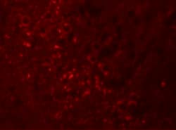 Invitrogen SPRYD5 Polyclonal Antibody 100 &mu;g | Buy Online | Invitrogen&trade; | Fisher Scientific