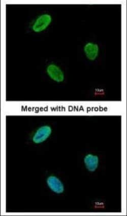 Invitrogen RAD9 Polyclonal Antibody 100 &mu;L; Unconjugated:Antibodies,