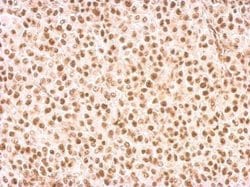 Invitrogen RAD9 Polyclonal Antibody 100 &mu;L; Unconjugated:Antibodies,