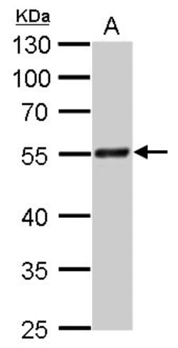 Invitrogen RAD9 Polyclonal Antibody 100 &mu;L; Unconjugated:Antibodies,