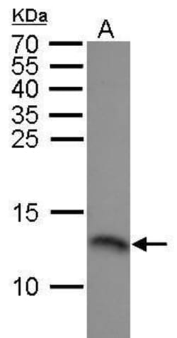 Invitrogen RPA14 Polyclonal Antibody 100 &mu;L | Buy Online | Invitrogen&trade; | Fisher Scientific