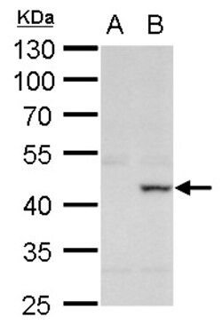 Invitrogen XRCC3 Polyclonal Antibody 100 &mu;L; Unconjugated:Antibodies,