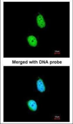 Invitrogen ERCC8 Polyclonal Antibody 100 &mu;L; Unconjugated:Antibodies,