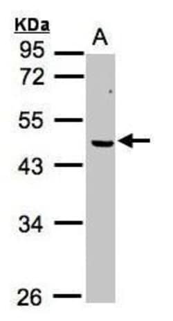 Invitrogen ERCC8 Polyclonal Antibody 100 &mu;L; Unconjugated:Antibodies,