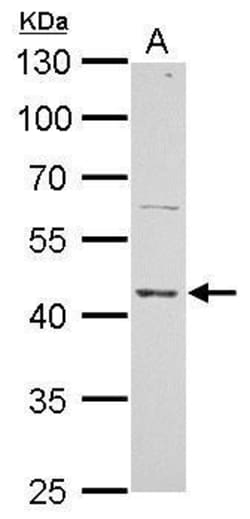 Invitrogen ERCC8 Polyclonal Antibody 100 &mu;L; Unconjugated:Antibodies,