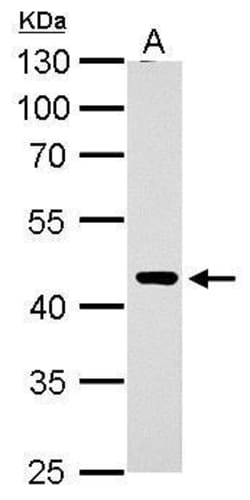 Invitrogen ERCC8 Polyclonal Antibody 100 &mu;L; Unconjugated:Antibodies,