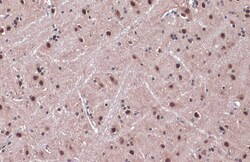 Invitrogen DDB1 Polyclonal Antibody 100 &mu;L; Unconjugated:Antibodies,