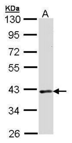 Invitrogen DMC1 Polyclonal Antibody 100 &mu;L; Unconjugated:Antibodies,