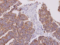 Invitrogen Cofilin 2 Polyclonal Antibody 100 &mu;L | Buy Online | Invitrogen&trade; | Fisher Scientific