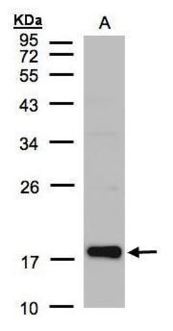 Invitrogen Cofilin 2 Polyclonal Antibody 100 &mu;L | Buy Online | Invitrogen&trade; | Fisher Scientific