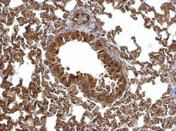 Invitrogen EML1 Polyclonal Antibody 100 &mu;L; Unconjugated:Antibodies,