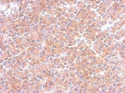 Invitrogen EML1 Polyclonal Antibody 100 &mu;L; Unconjugated:Antibodies,