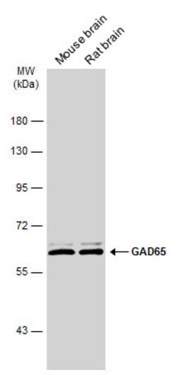 Invitrogen GAD65 Polyclonal Antibody 100 &mu;L; Unconjugated:Antistoffer