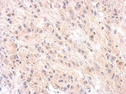 Invitrogen Complement Factor H Polyclonal Antibody 100 &mu;L; Unconjugated:Antibodies,