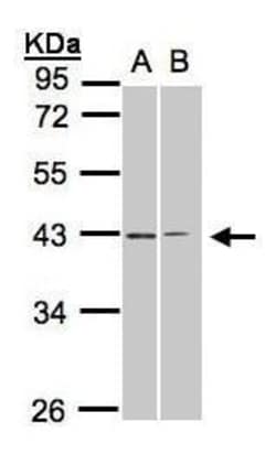 GALR2 Polyclonal Antibody, Invitrogen 100 &mu;L | Buy Online | Invitrogen | Fisher Scientific