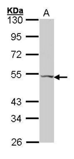 VPAC2 Polyclonal Antibody, Invitrogen 100 &mu;L | Buy Online | Thermo Scientific | Fisher Scientific