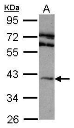 ADORA2A Polyclonal Antibody, Invitrogen 100 &mu;L; Unconjugated:Antibodies,