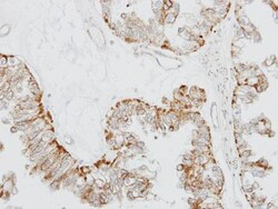 OR51E1 Polyclonal Antibody, Invitrogen 100 &mu;L; Unconjugated:Antibodies,