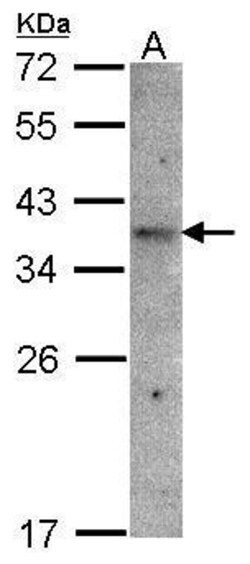 OR51E1 Polyclonal Antibody, Invitrogen 100 &mu;L; Unconjugated:Antibodies,