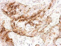 GALR2 Polyclonal Antibody, Invitrogen 100 &mu;L; Unconjugated:Antibodies,