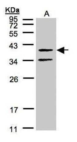 GALR2 Polyclonal Antibody, Invitrogen 100 &mu;L; Unconjugated:Antibodies,