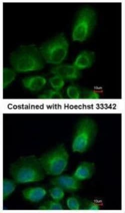Invitrogen UBE2B Polyclonal Antibody 100 &mu;L; Unconjugated:Antibodies,