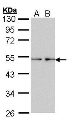 Invitrogen Fascin Polyclonal Antibody 100 μL; Unconjugated:Antibodies,