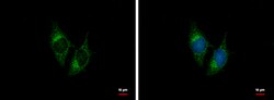 Invitrogen BNP Polyclonal Antibody 100 &mu;L; Unconjugated:Antibodies,