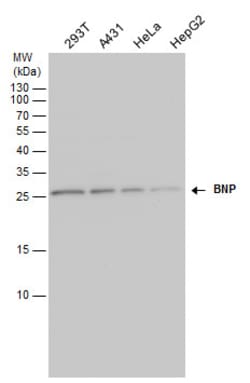 Invitrogen BNP Polyclonal Antibody 100 &mu;L; Unconjugated:Antibodies,