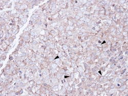 Invitrogen SCARA3 Polyclonal Antibody 100 &mu;L; Unconjugated:Antibodies,