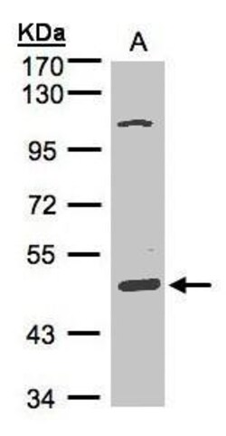 Invitrogen SCARA3 Polyclonal Antibody 100 &mu;L; Unconjugated:Antibodies,