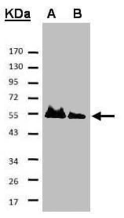 Invitrogen HICE1 Polyclonal Antibody 100 &mu;L; Unconjugated:Antibodies,