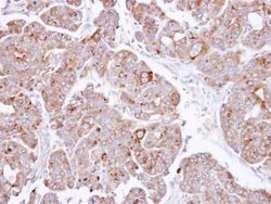Invitrogen PSAP Polyclonal Antibody 100 &mu;L | Buy Online | Invitrogen&trade; | Fisher Scientific