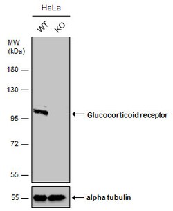 Invitrogen Glucocorticoid Receptor Polyclonal Antibody 100 μL; Unconjugated:Antibodies,