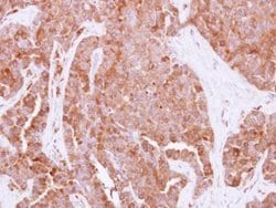 Invitrogen HPRT1 Polyclonal Antibody 100 &mu;L; Unconjugated:Antibodies,