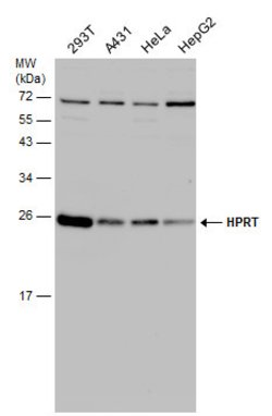Invitrogen HPRT1 Polyclonal Antibody 100 &mu;L; Unconjugated:Antibodies,