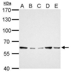 Invitrogen GGT1 Polyclonal Antibody 100 &mu;L; Unconjugated:Antibodies,
