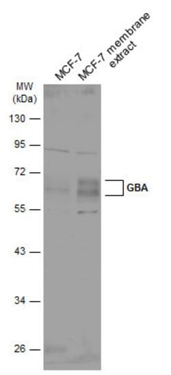 Invitrogen GBA Polyclonal Antibody 100 &mu;L; Unconjugated:Antibodies,