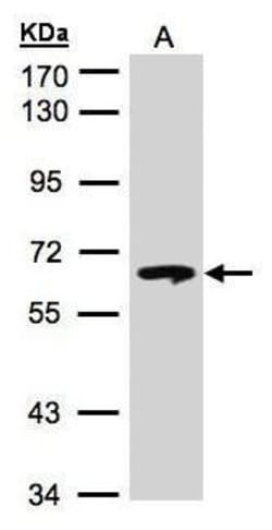 Invitrogen GBA Polyclonal Antibody 100 &mu;L; Unconjugated:Antibodies,