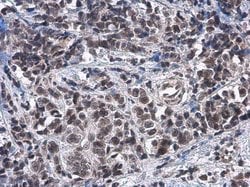 Invitrogen ATRX Polyclonal Antibody 100 &mu;L; Unconjugated:Antibodies,