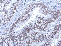 Invitrogen ATRX Polyclonal Antibody 100 &mu;L; Unconjugated:Antibodies,