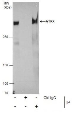Invitrogen ATRX Polyclonal Antibody 100 &mu;L; Unconjugated:Antibodies,