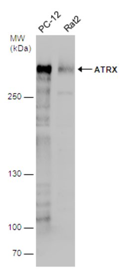 Invitrogen ATRX Polyclonal Antibody 100 &mu;L; Unconjugated:Antibodies,