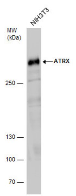 Invitrogen ATRX Polyclonal Antibody 100 &mu;L; Unconjugated:Antibodies,