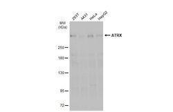 Invitrogen ATRX Polyclonal Antibody 100 &mu;L; Unconjugated:Antibodies,