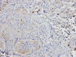 Invitrogen A-Raf Polyclonal Antibody 100 &mu;L; Unconjugated:Antibodies,
