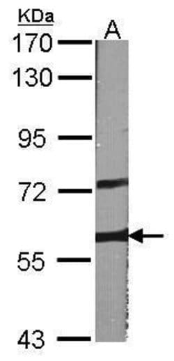 Invitrogen A-Raf Polyclonal Antibody 100 &mu;L; Unconjugated:Antibodies,