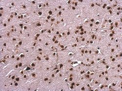 Invitrogen SAFB Polyclonal Antibody 100 &mu;L | Buy Online | Invitrogen&trade; | Fisher Scientific